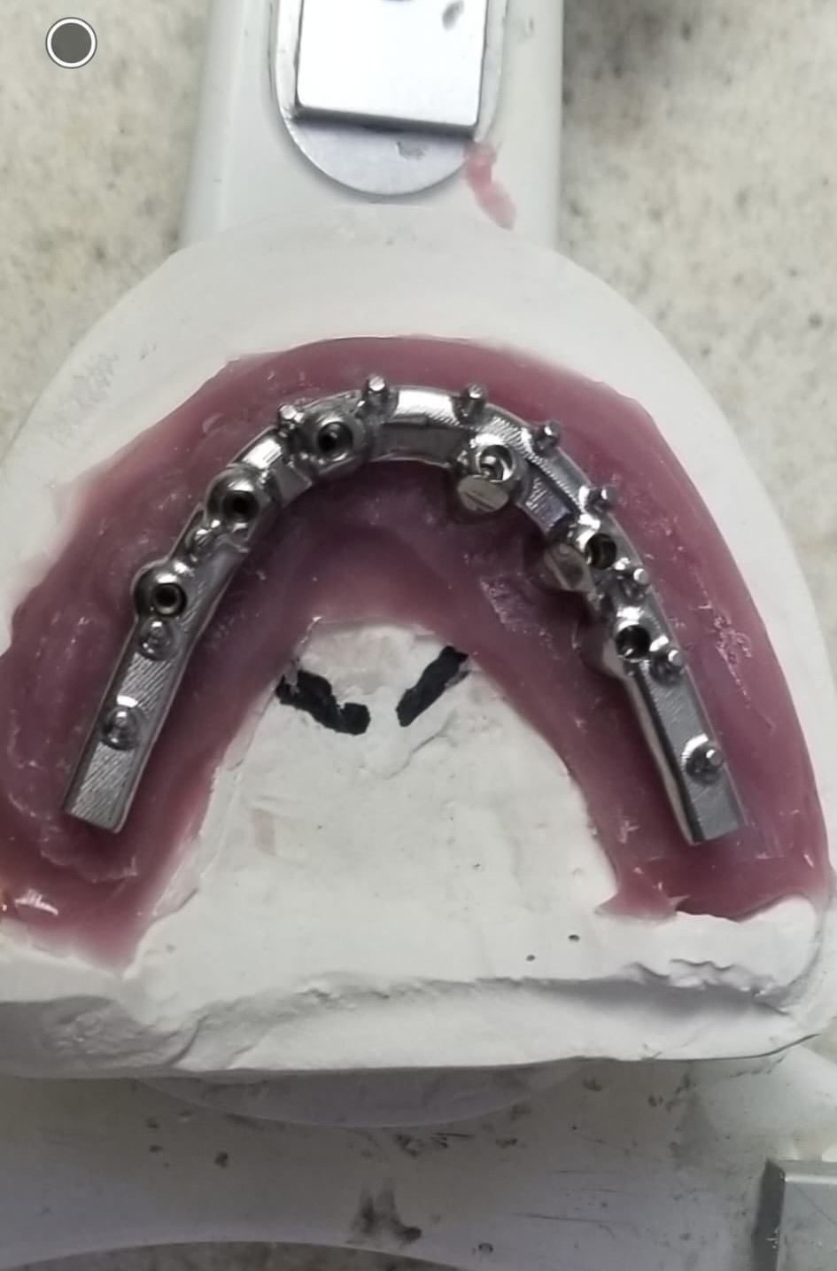 Titanium CAD/CAM Bar Hybrid